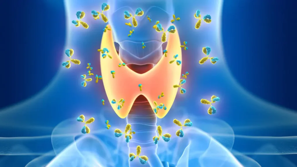 Thyroid dysfunction. 